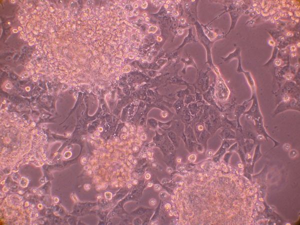 Coronavirus