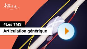 TMS - Articulation générique