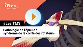 TMS - Pathologie de l'épaule - Syndrome de la coiffe des rotateurs